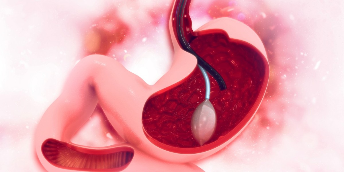 Is A Gastric Balloon Safe?