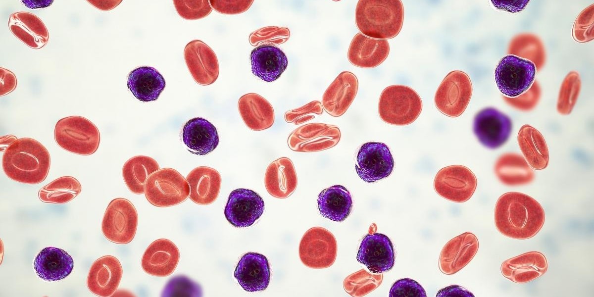 Chronic Myelomonocytic Leukemia Market Size, Trends, and Growth Forecast 2025-2032