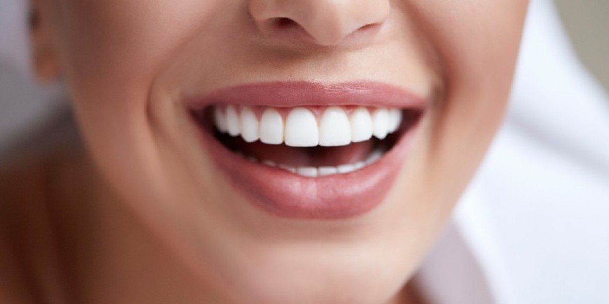 Bite Correction Through Full Mouth Reconstruction