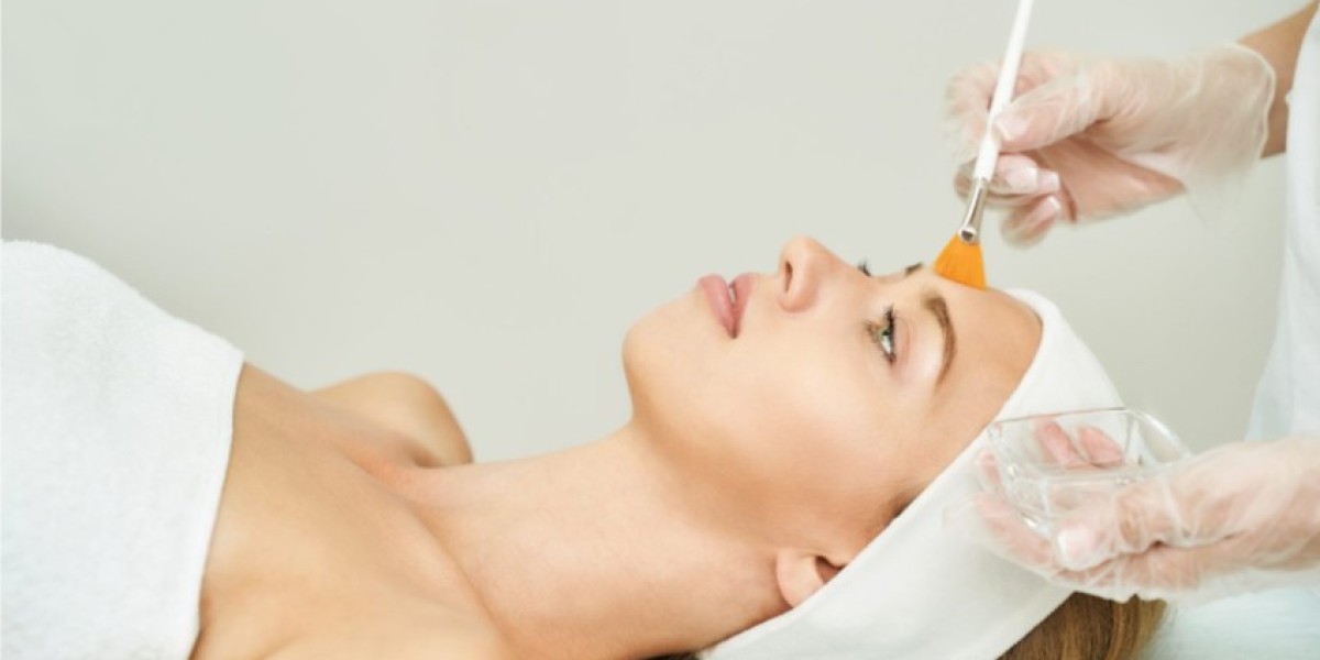 Avoiding Side Effects of Chemical Peels in Islamabad