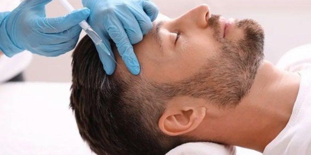 Men’s Guide to PRP Hair Loss Treatment in Riyadh