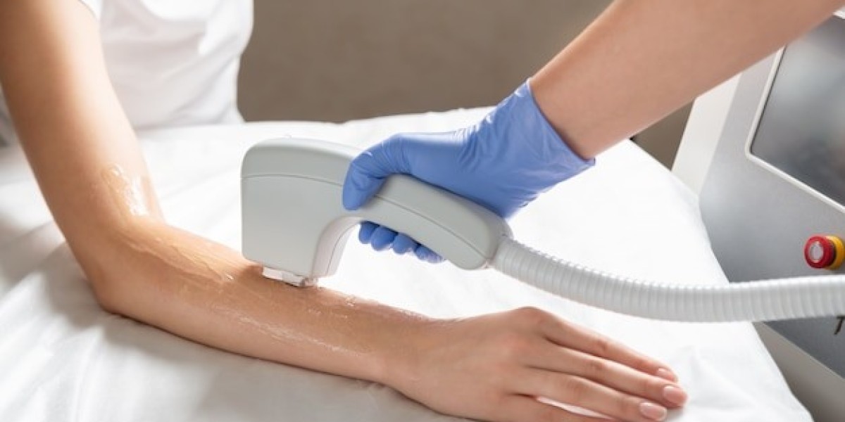 Can Laser Hair Removal Trigger More Hair Growth?