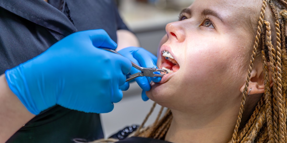 Periodontal Disease Surgery for Advanced Gum Health