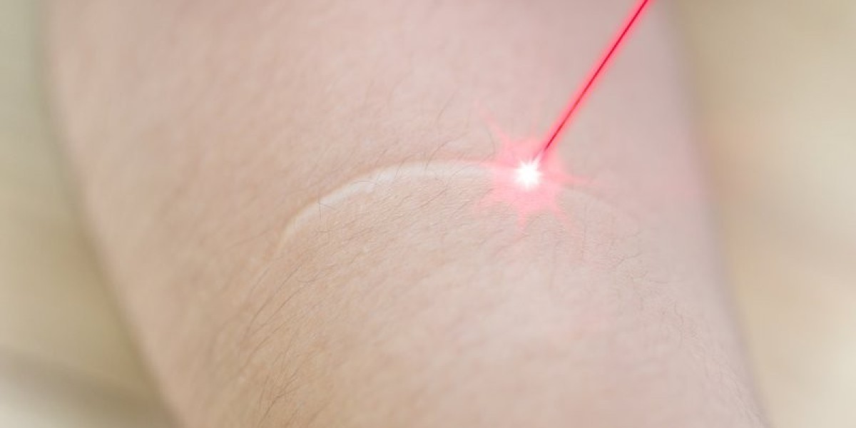 Breaking Down the Laser Scar Removal Cost in Dubai by Treatment Type
