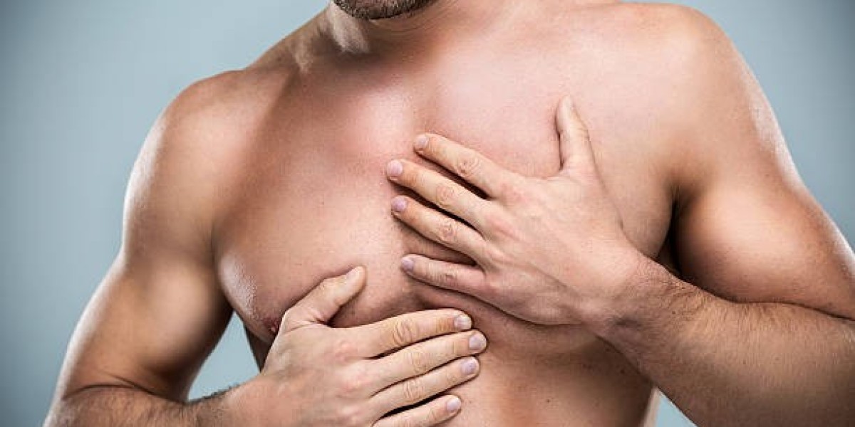 How Long Is Recovery After Gynecomastia Surgery in Riyadh?