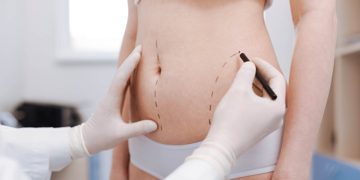 Affordable Liposuction cost Is It Possible?