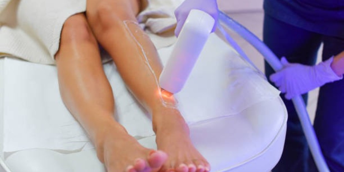 How to Prepare for Laser Hair Removal in Riyadh