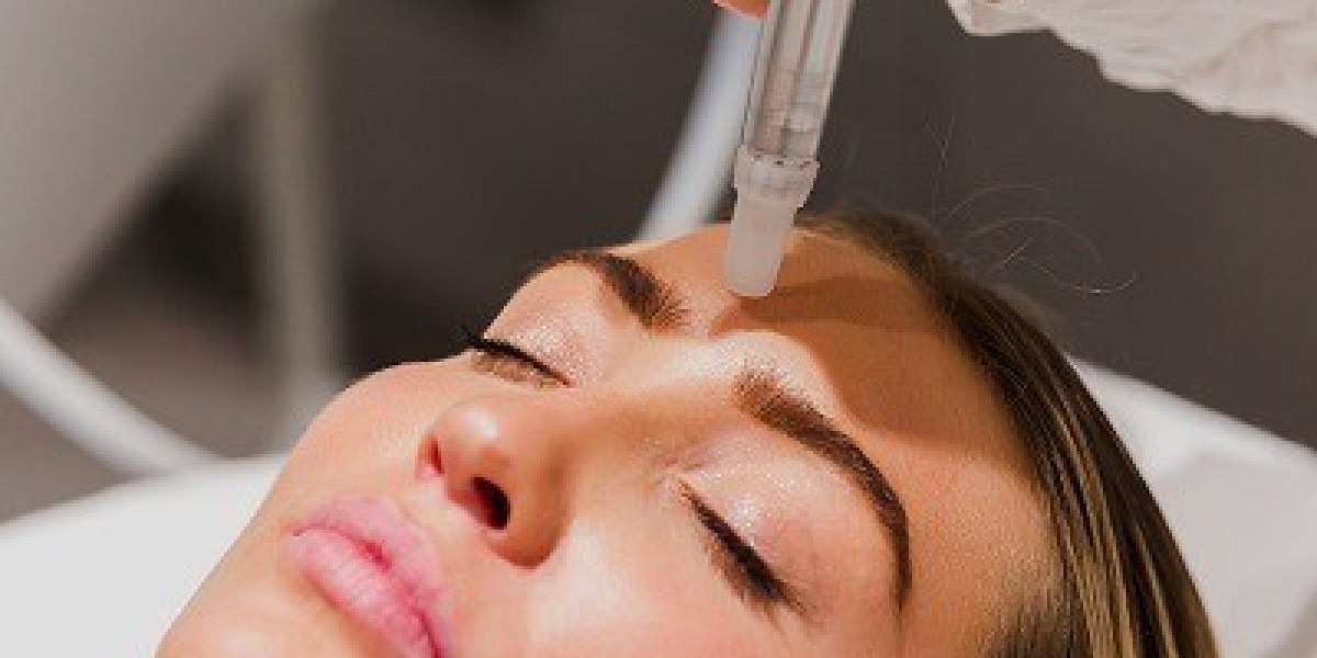 Why Pico Laser Treatment Is a Go-To for Skin Brightening