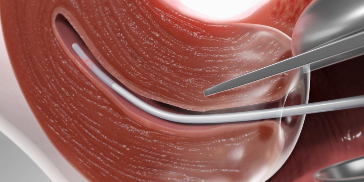 Global Biopsy Devices Market – Analysis, Share and Forecast 2022-2032
