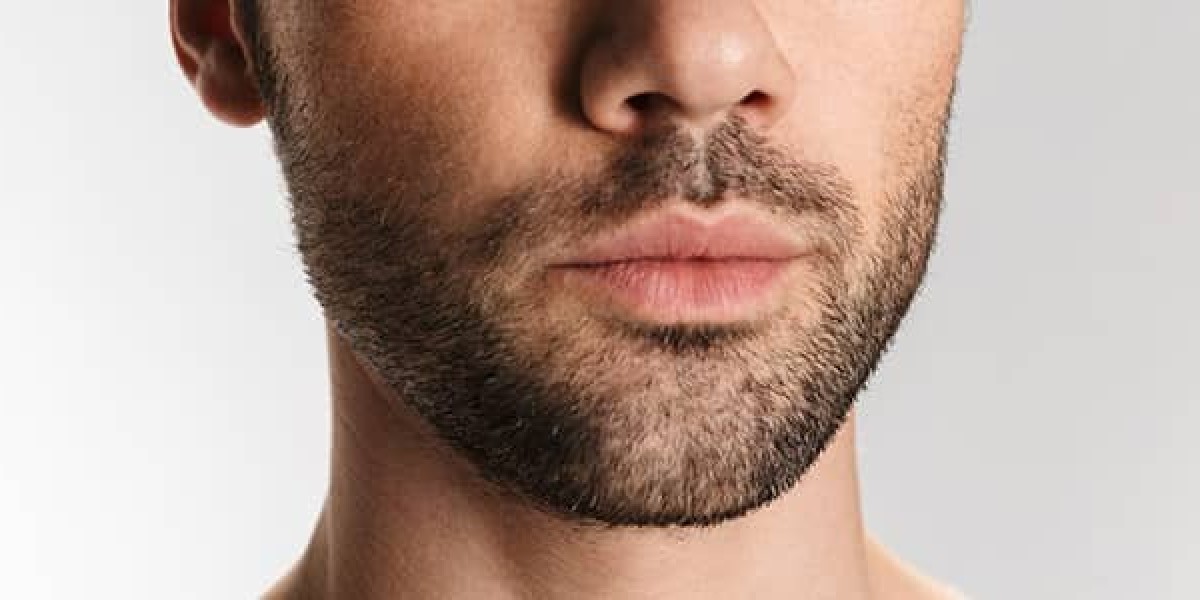 What Makes a Mustache Hair Transplant Look Natural?