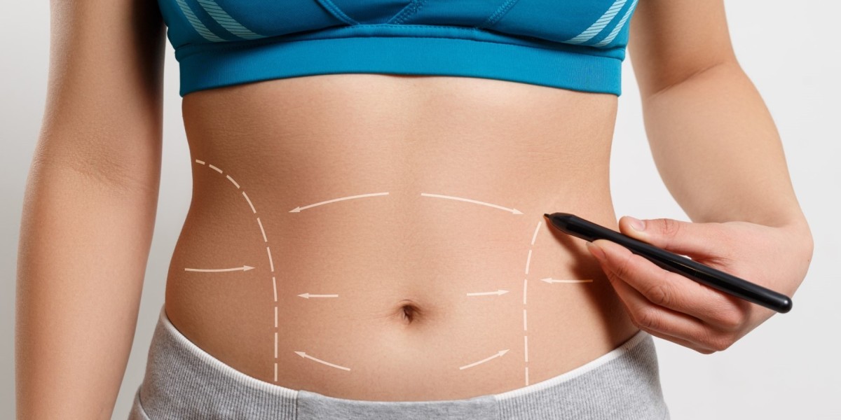 Thigh Liposuction in Islamabad: Slim Legs Are Possible