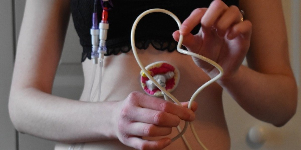 How Tube Feeding at Home in Dubai Works