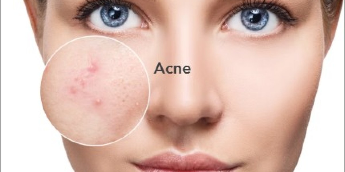 Calgary Cosmetic Dermatologist – Your Partner in Healthy Skin Transformation