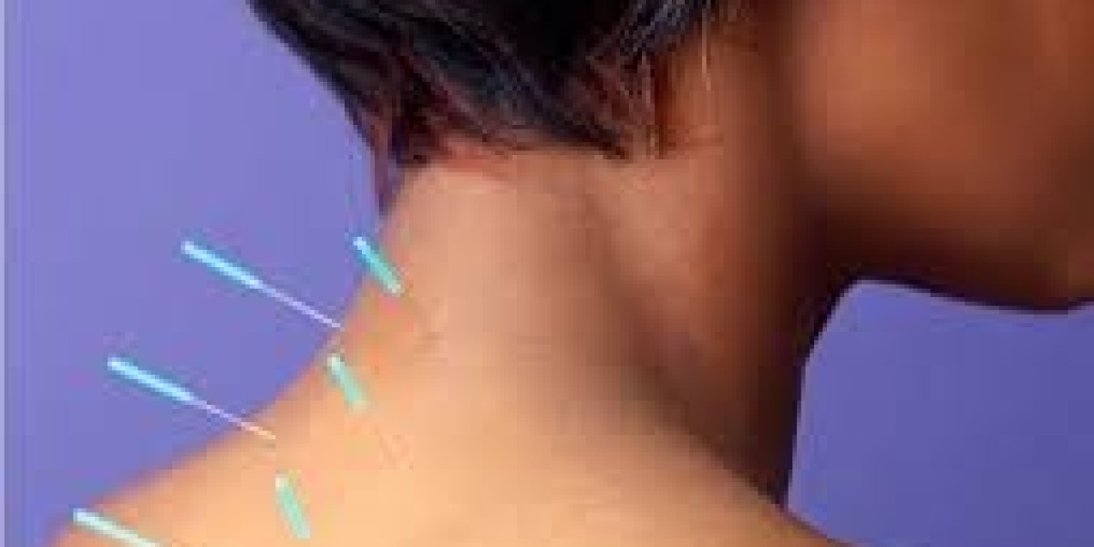Relieve Chronic Pain Naturally with Acupuncture for Pain in Morristown