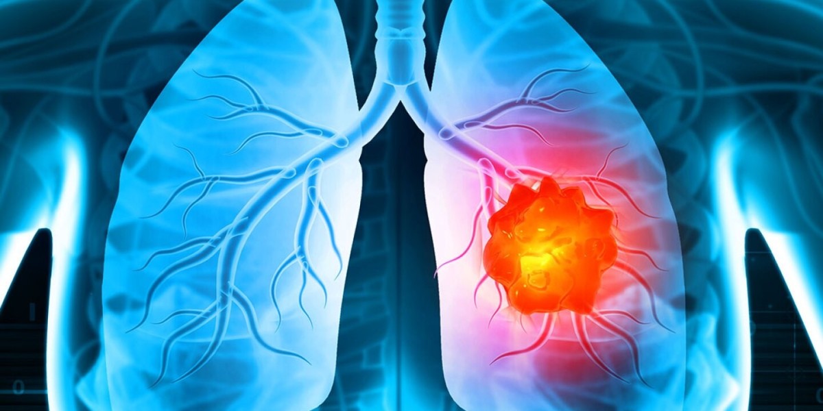 Cancer Pain Market Size, Trends, and Strategic Outlook 2025-2032