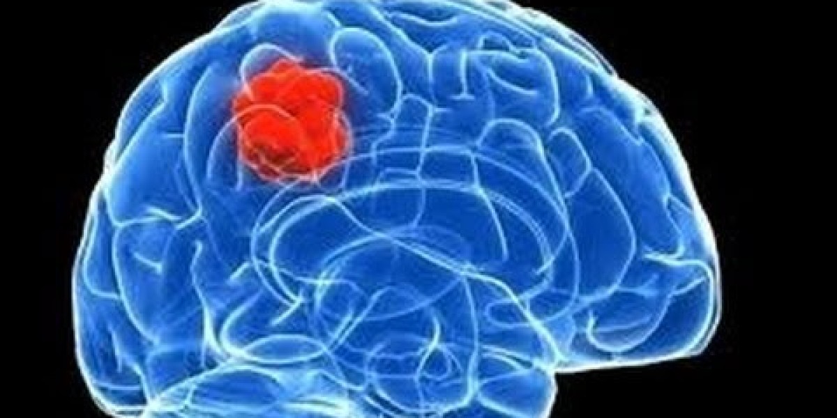 Glioblastoma Market Size, Trends, and Growth Strategies 2025-2032