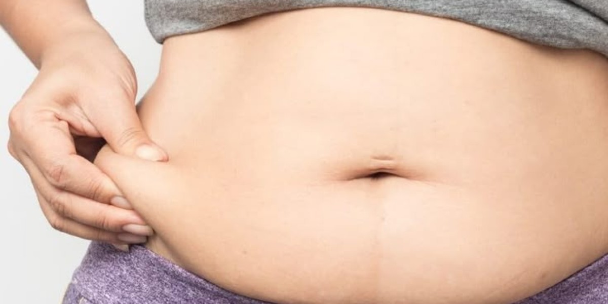 What Are the Recovery Times for Liposuction in Riyadh?