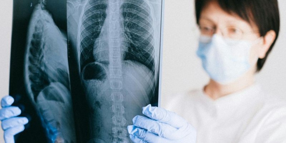 Key Insights Into Symptoms Lung Cancer Stages You Must Know