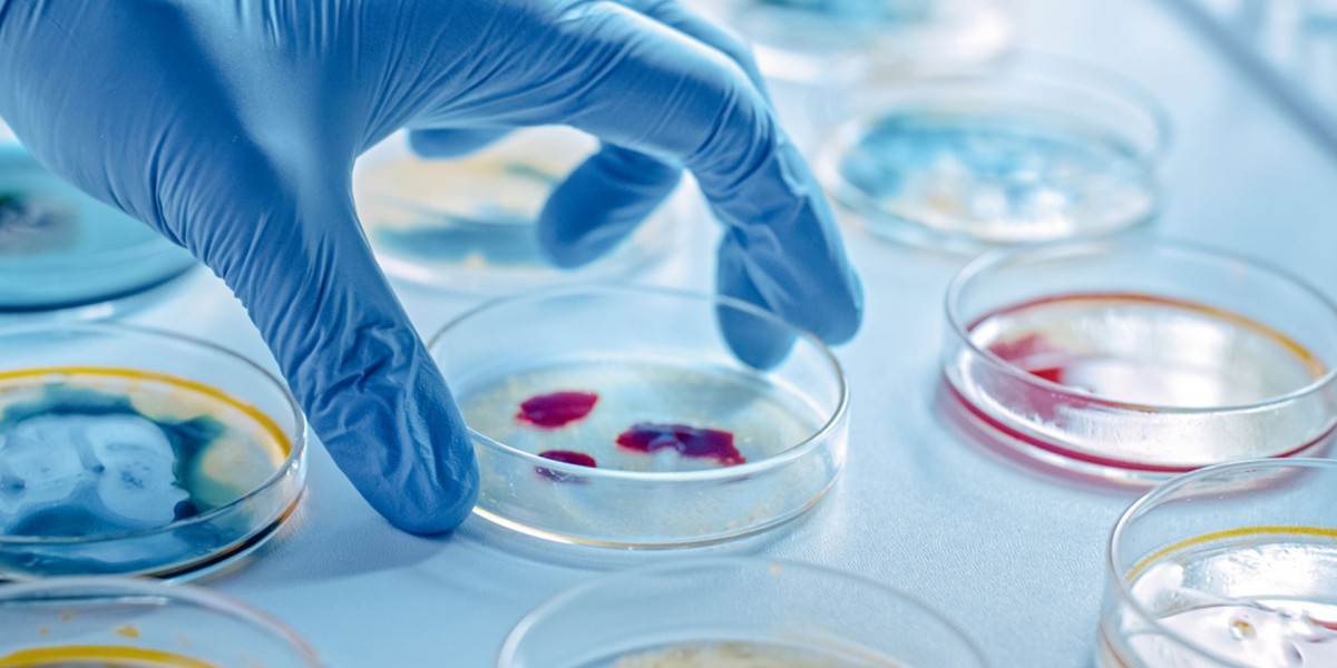 Antimicrobial Additives Market Size, Trends, and Strategic Outlook 2025-2032