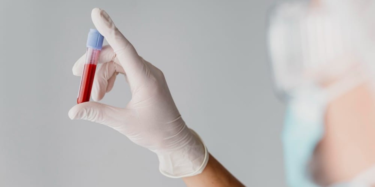 Best Blood Test at Home for Keto and Low-Carb Dieters