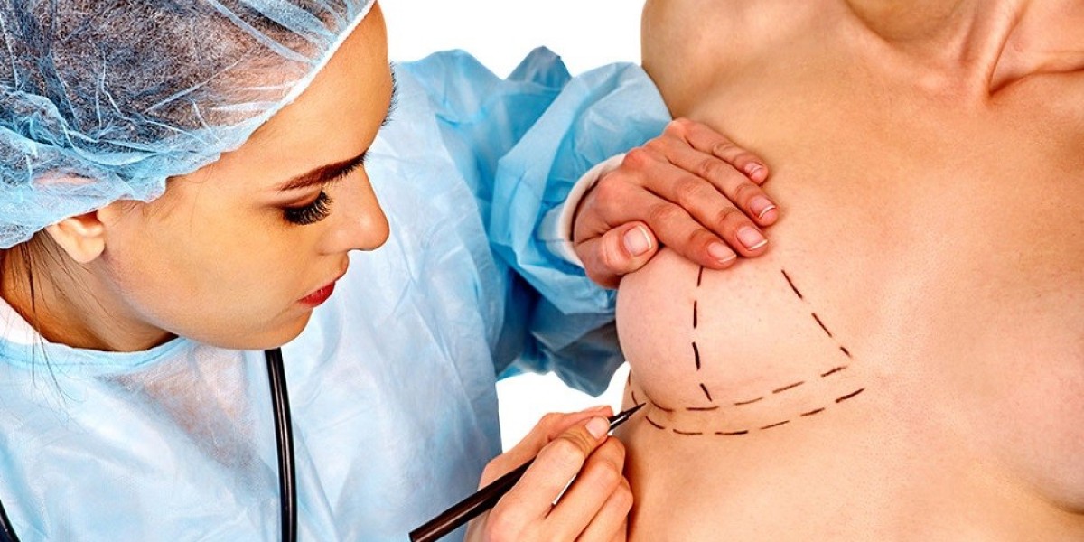 Breast Reduction vs. Lift: Riyadh’s Best Option