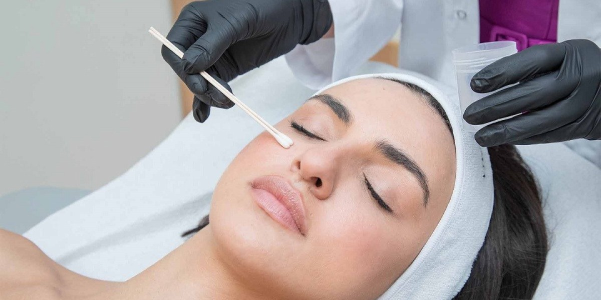 Chemical Peels and Skin Hydration: What to Know