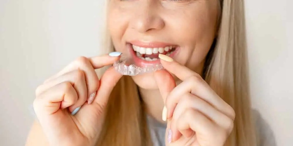 How Long Do Composite Veneers Last? Tips to Extend Their Lifespan