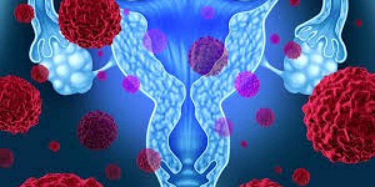 Uterine Fibroid Treatment Market Driven by Increasing Prevalence and Demand for Minimally Invasive Procedures