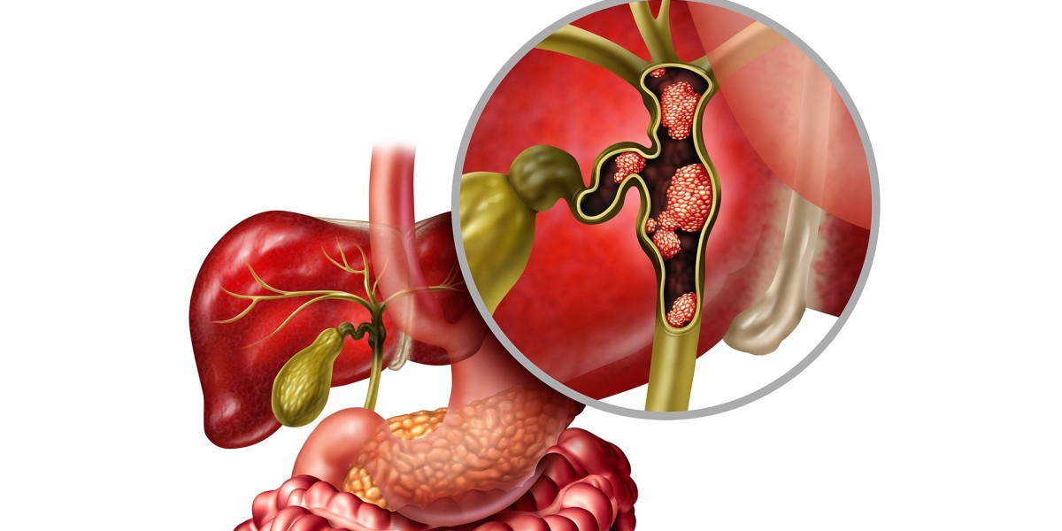 Biliary Tract Cancers Market: Size, Trends, and Strategic Insights to 2032