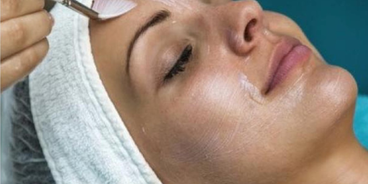 What Is a Radiance Peel and How Does It Work?