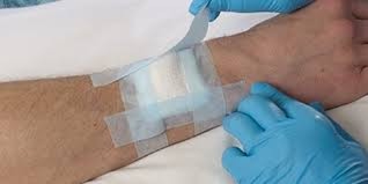 Medical Adhesives Market Strategic Moves Enhancing Competitive Position and Market Reach