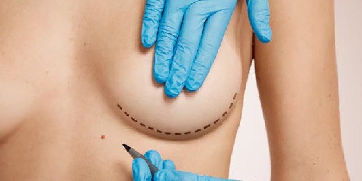 Affordable Breast Surgery Cost at Top Clinic in Europe
