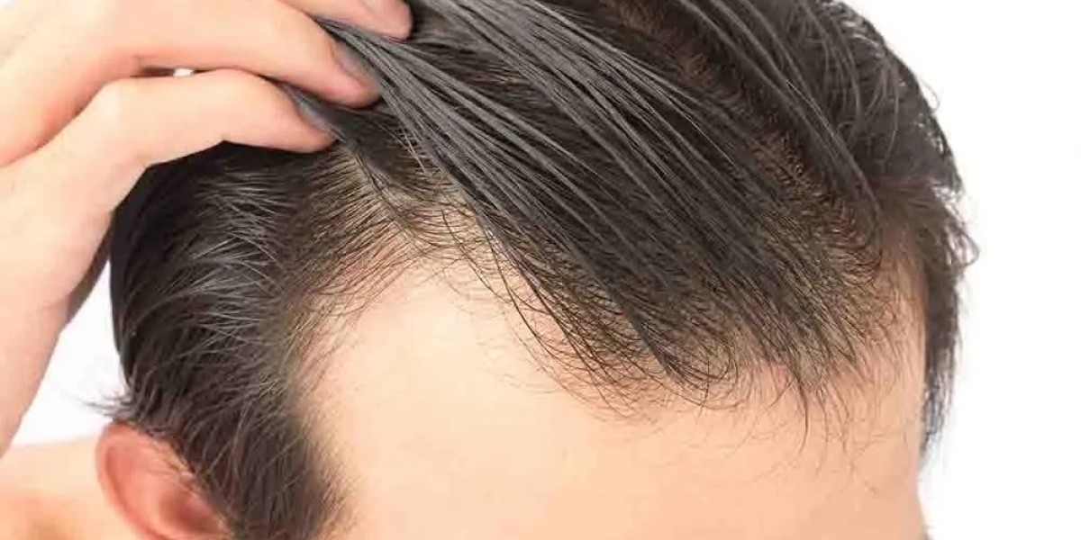 Does Front Line Hair Fixing Look Natural?