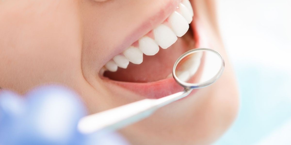 Painless Teeth Polishing Services Riyadh