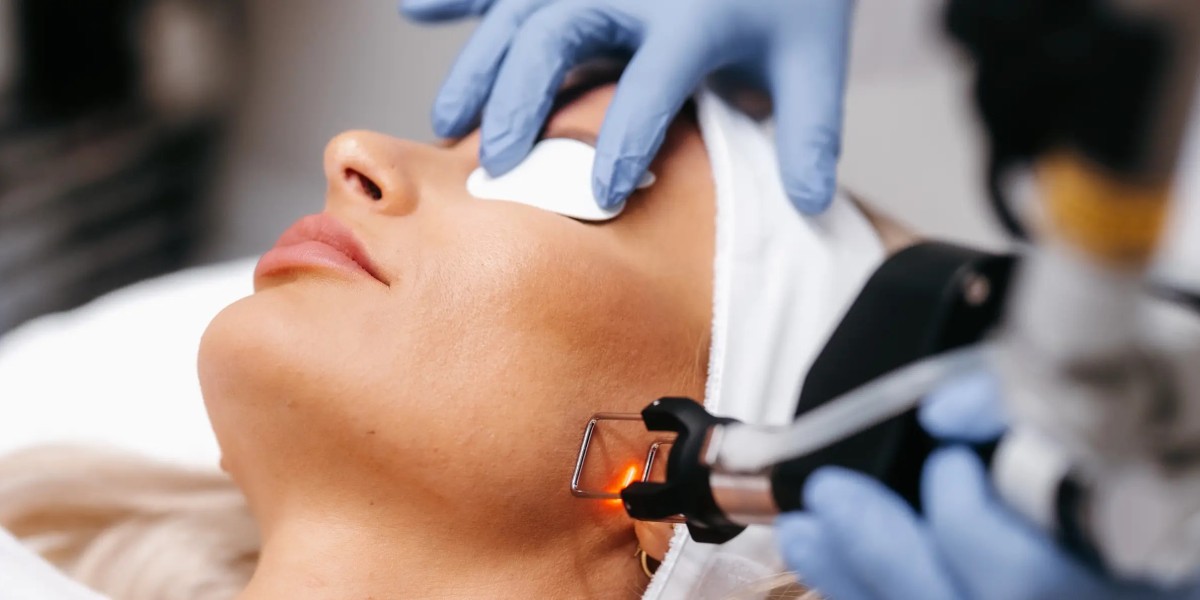 People Love Fractional CO2 Laser Treatment Cost in Dubai