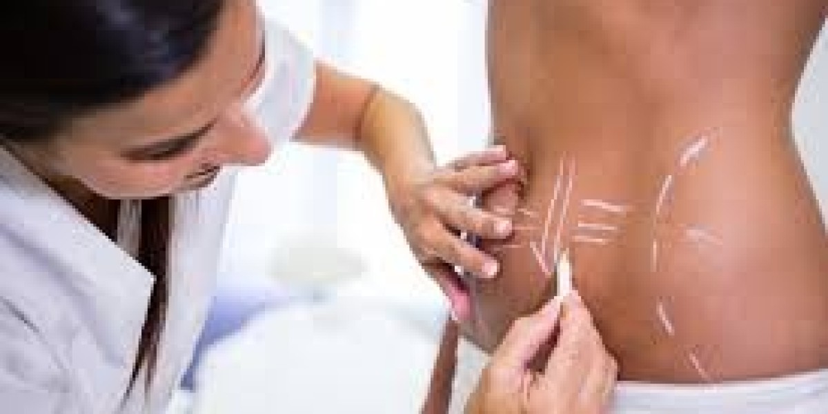 What Factors Affect the Cost of a Tummy Tuck Surgery?