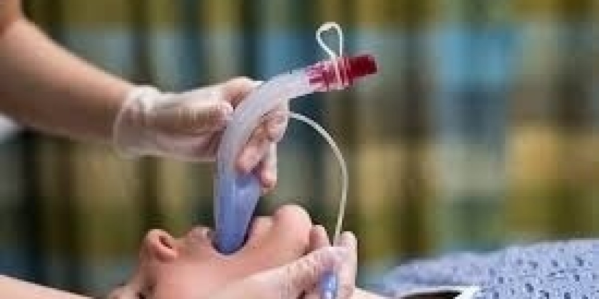 Global Airway Management Devices Market Outlook: Trends, Growth & Forecast to 2032