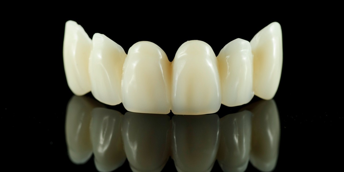 What to Expect After a Dental Crown in Dubai?