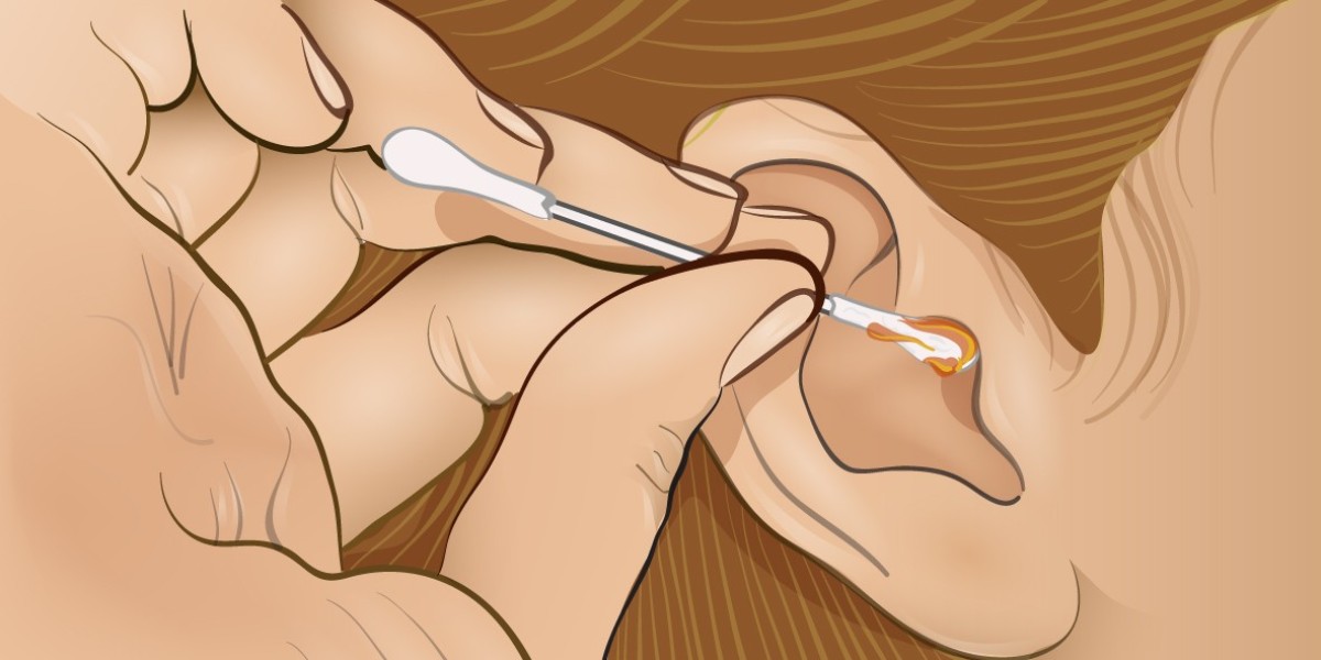 Global Cerumen Removal Market Growth and Strategic Insights 2025-2032