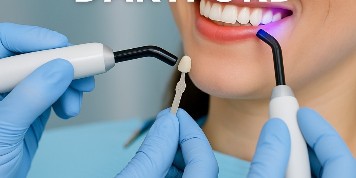 Quick & Effective Smile Fixes with Composite Bonding in Dartford