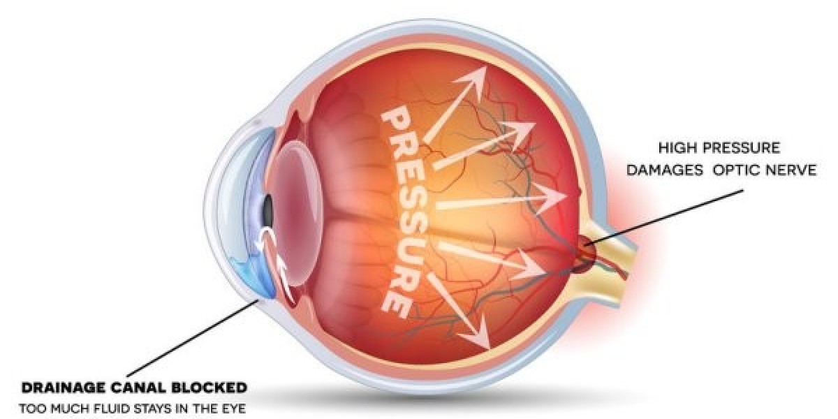 Global Glaucoma Treatment Market Growth Drivers and Challenges: Outlook 2022–2032