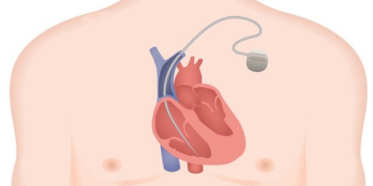 Implantable Cardiac Monitors Market : Size, Trends, and Growth Forecast to 2032