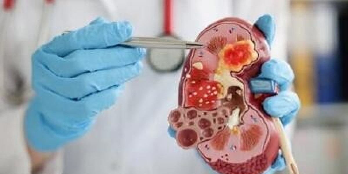 Kidney Transplant Rejection Market: Size, Trends, and Strategic Insights 2025-2032