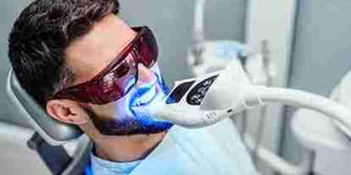 What Makes Dentist-Led Whitening More Effective