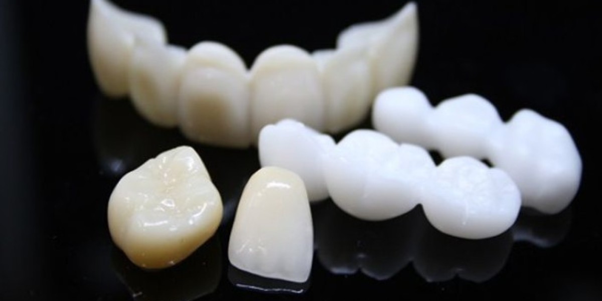 Độ bền của răng sứ duy trì được trong bao lâu?