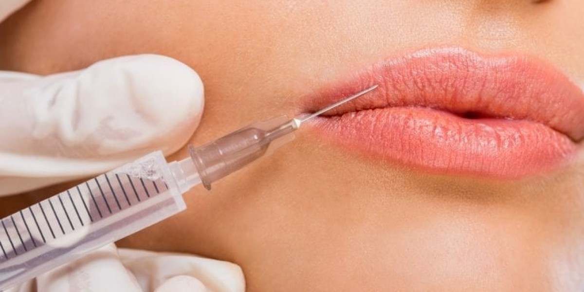 Are Lip Fillers Effective for Uneven Lips?