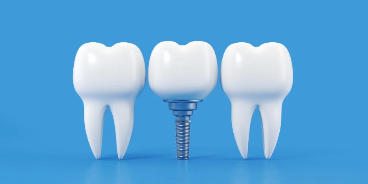Define What Beauty Means with Dental Implants in Dubai