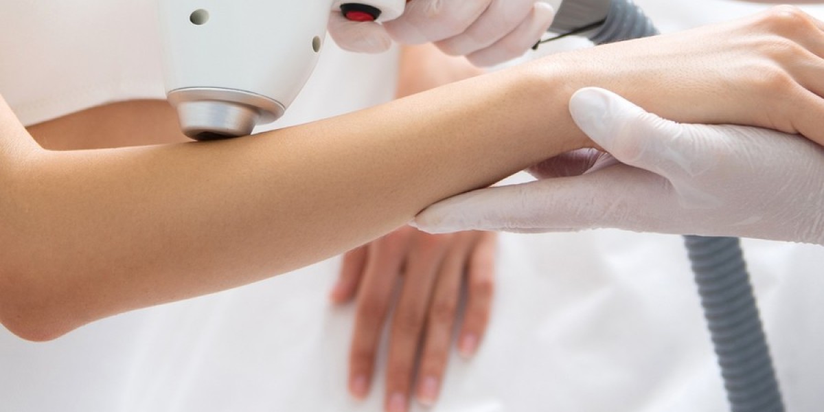 What Are the Benefits of Laser Hair Bleaching?