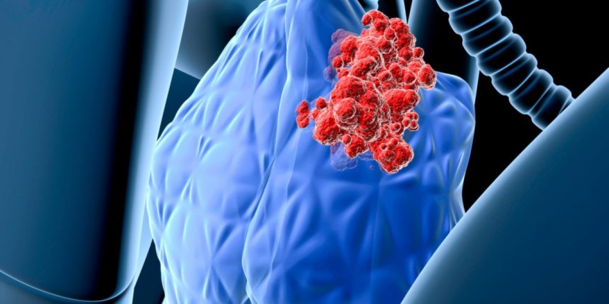Thymic Carcinoma Drugs Market Size, Trends, and Strategic Outlook 2025-2032