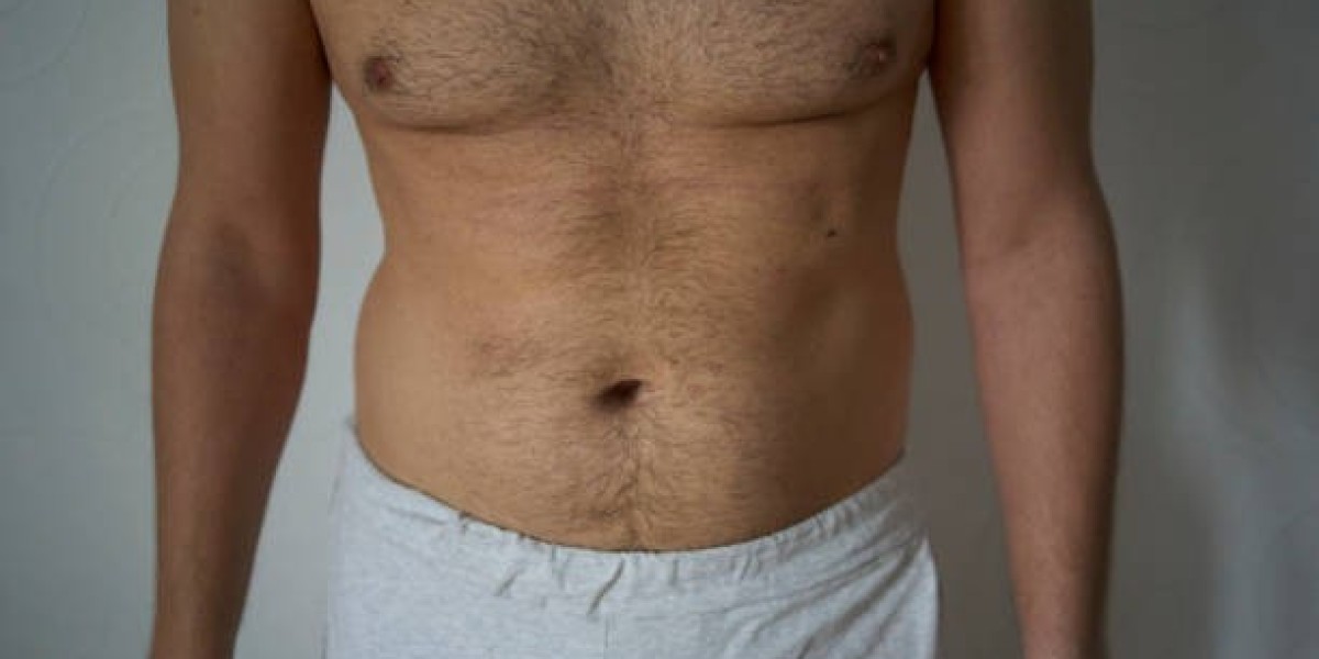Top Clinics for Gynecomastia Surgery in Riyadh